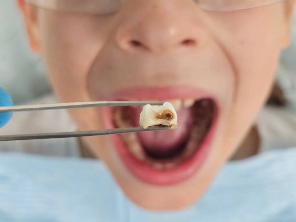 Best Emergency Tooth Extraction in East Pittsburgh, PA